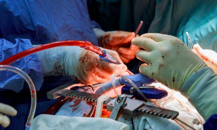 Australians will automatically have their organs donated after they die under a new proposal