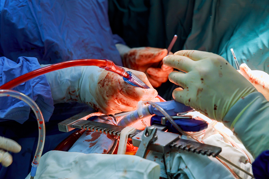 Australians will automatically have their organs donated after they die under a new proposal