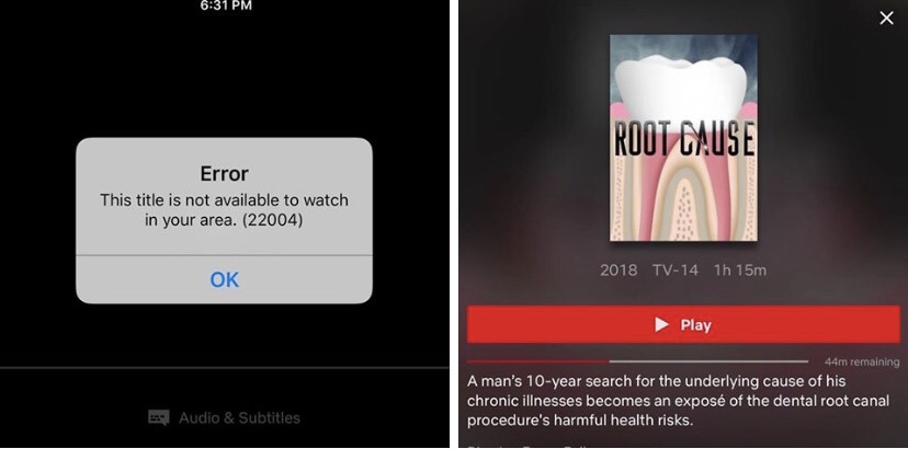 Netflix pulls controversial documentary that claims root canals cause cancer