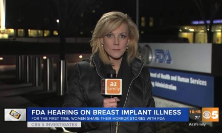 CBS: FDA weighs possible cancer risks of textured breast implants