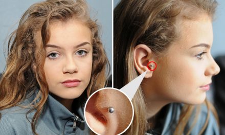 School bans girl, 15, from lessons over ‘holistic earring’ that mom explains ‘stops her getting migraines’