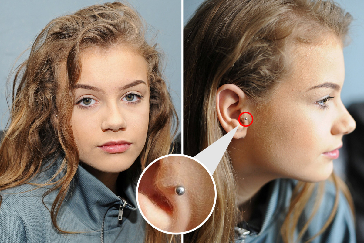 School bans girl, 15, from lessons over ‘holistic earring’ that mom explains ‘stops her getting migraines’