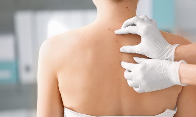 Fat intake linked to skin cancer risk