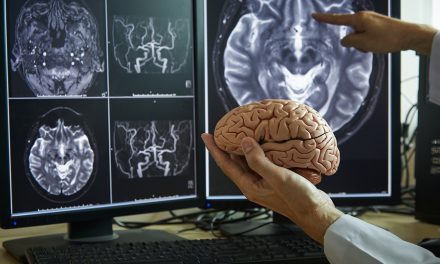 How WHOLE Turmeric heals the damaged brain
