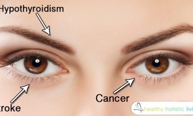 14 Things Your Eyes Are Trying To Tell You About Your Health