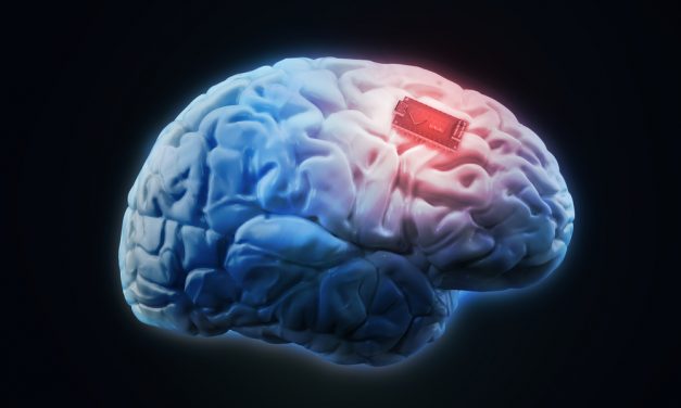 Elon Musk Is Making Implants to Link the Brain With a Smartphone